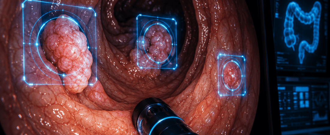 Cáncer de Colon con IA: la Detección Increíble en Colonoscopia de 2026